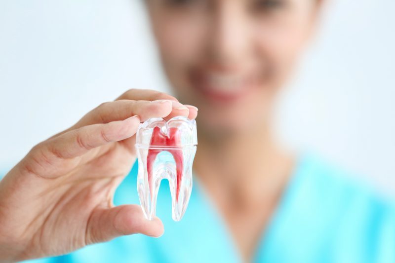 Tratamento de canal - Rideto Odontologia e Estética